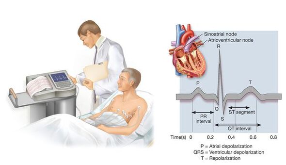 Électrocardiographie pour détecter les maladies cardiovasculaires avec hypertension